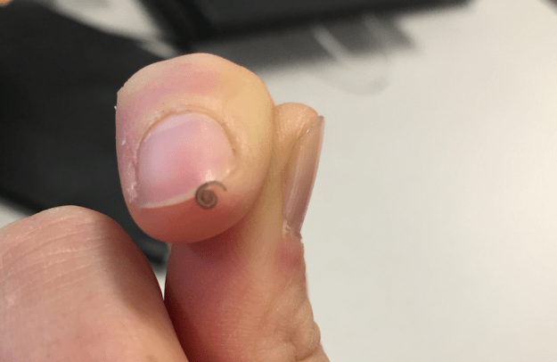 Kind of looks like I'm balancing a severed finger tip